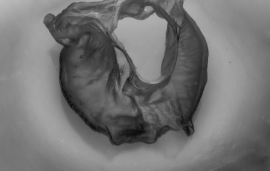 Görkem Ergün, Phase:Repair, 2021.