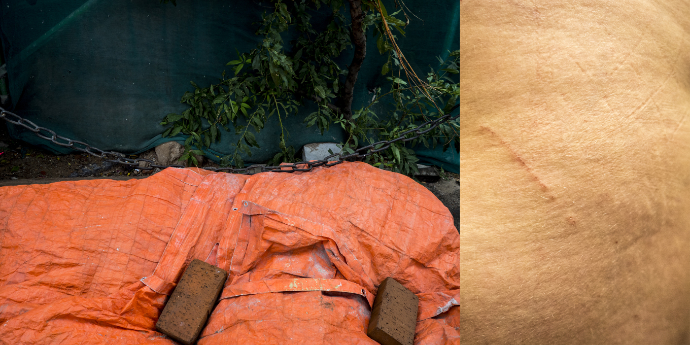 Jagoda Malanin, Kože, v katerih živimo (Skins we live in), 2020-2021.